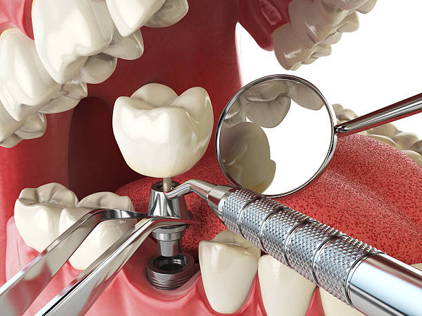 Best Emergency Treatment for Oral Infections in Tuntutuli, AK